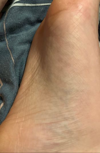 Pieds