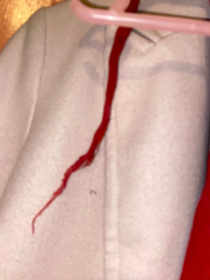 Tunique - photo numéro 2