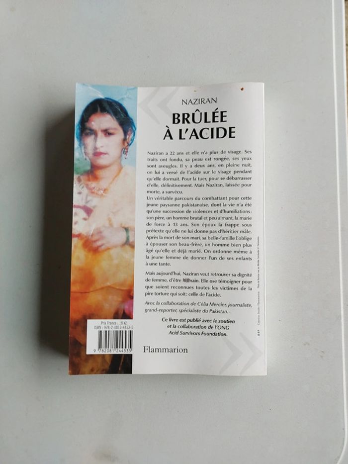 Brûlée à l'acide - photo numéro 2