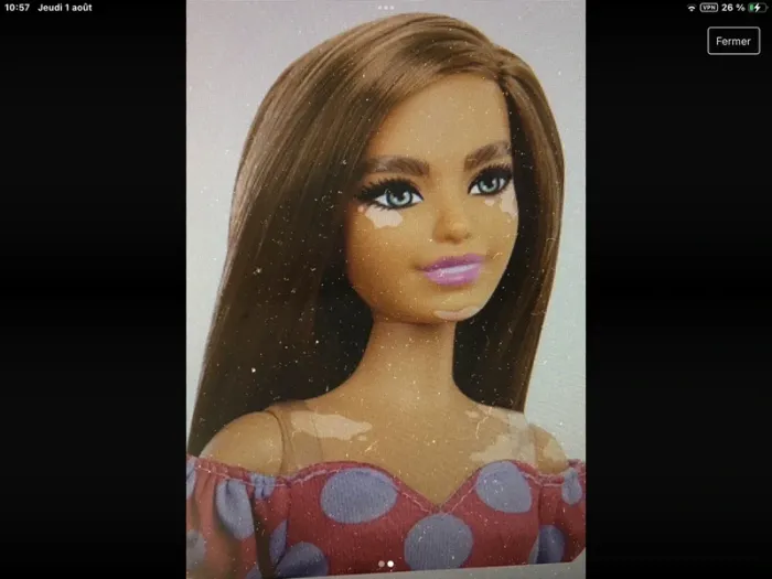 Poupée barbie genrée vitiligo - photo numéro 2