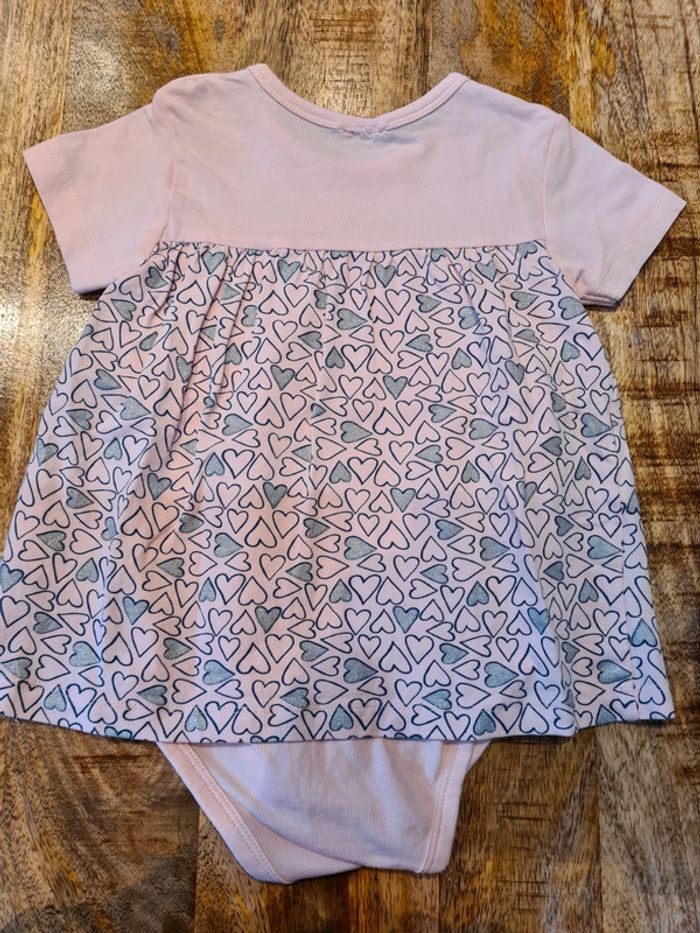 Robe body 9/12 mois - photo numéro 2