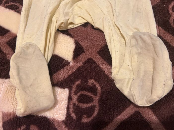 Grenouillère - photo numéro 5