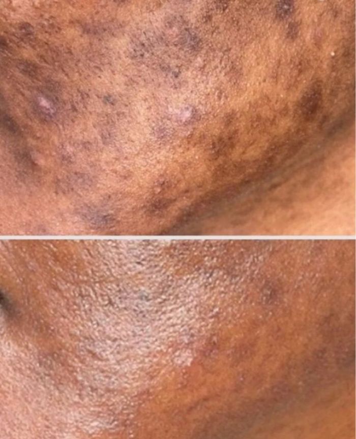 Sérum liqueur 25 PSKYN - photo numéro 2