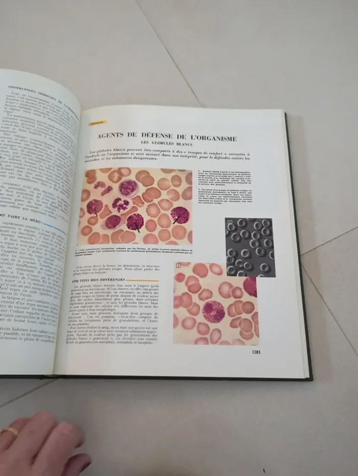 Encyclopédie médecine pour vous tome 6 hachette - photo numéro 3