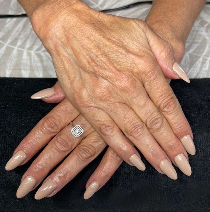 Ongles