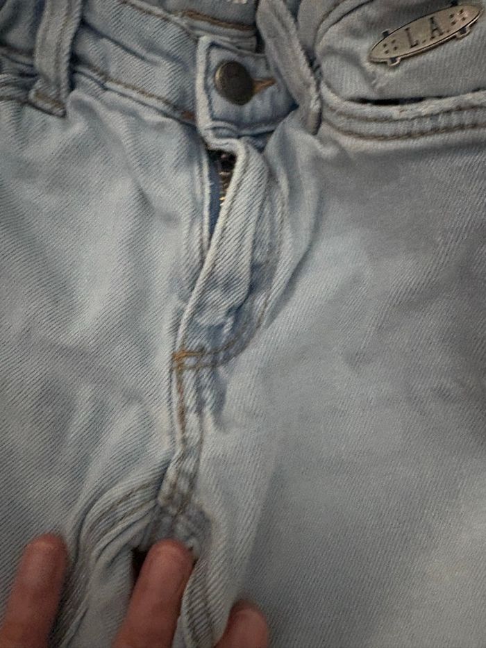 Jean 4 ans tape a l’œil - photo numéro 2