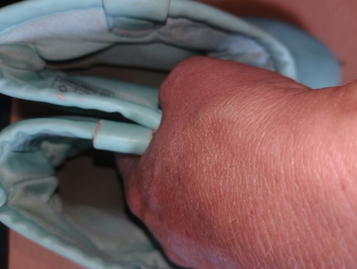 Botte verte 34
En état moyen - photo numéro 9